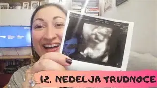 TRUDNOCA PO NEDELJAMA | 12. NEDELJA TRUDNOCE | 12 WEEKS PREGNANCY UPDATE