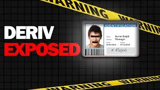 STOP! DON'T Sign Up For Deriv Until You See This $10,000 Mistake
