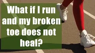 What if I run and my broken toe does not heal?