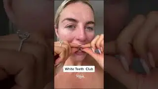 Get a Polished White Smile &ndash; #PolishedLondon #teethwhitening #ukbrand