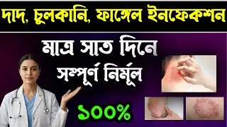 ফাঙ্গাল ইনফেকশন দূর করার আসল ঘরোয়া উপায় | Best Natural Treatment for Fungal Infection