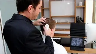 Haarkenmerken en een haartransplantatie - Vinci Hair Clinic