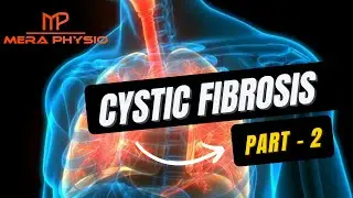 Cystic Fibrosis - part 2 | Signs & Symptoms, Diagnosis | In Hindi | Mera Physio