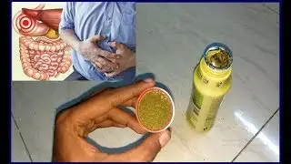 Constipation Gas Acidity Ayurvedic Treatment Pet Saffa ! Honest Review in Hindi !