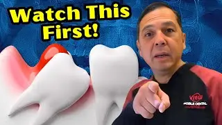 Wisdom Tooth 101: Dentist Explains Symptoms, Causes, and Treatment Options