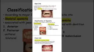 orthodontics basic terms on YouTube Now ▶️ dr#dentistry #dentistryworld  #dentistry #malocclusion