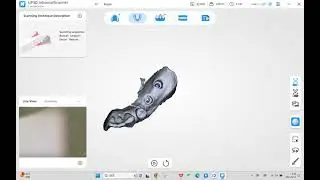 [UP3D] Dental Intraoral Scanner - Custom Implant Scanning Workflow