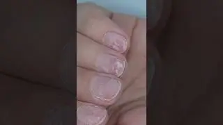 Tissue- thin nails 🤧 How to fix it ? #nails #nailtutorial #gelmanicure