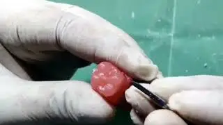 Carving of Permanent Maxillary 1st Molar
