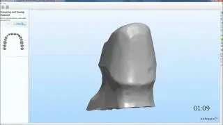 K&auml;ppchen in weniger als 2 min im 3shape DentalSystem - powered by WIELAND