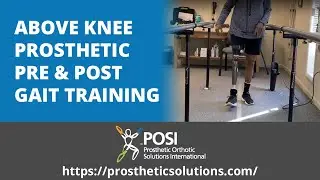 Above Knee Prosthetic Pre & Post Gait Training | Prosthetic Orthotic Solutions International