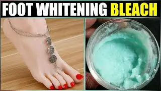 Special Feet WHITENING PEDICURE at Home || Remove Sun Tan || S.C