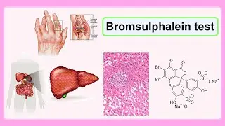 bromsulphalein test