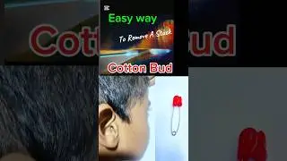 Извлечение застрявшей ватной палочки из уха #😩🙉👂