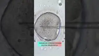 Когда нельзя без ИКСИ