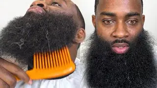 his beard is ABSOLUTELY MASSIVE