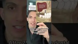 25 Years After a Dental Fail Now What?