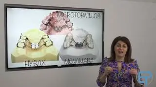 Disyuntor y  placa de expansión en ortodoncia. Qué  es y cual es su función