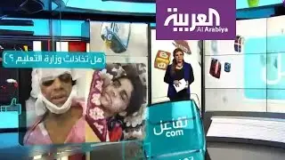 تفاعلكم: طالبة تروي حادثة حرقها و التعليم السعودي يوضح