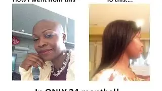 Black Hair Can Grow Long  -Part2