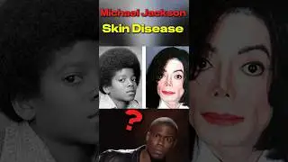 Michael Jackson Skin problem? #facts #shorts #michaeljackson #trending