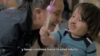 Austin Smiles - Cleft Care Documentary