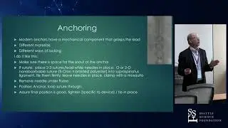Implant Techniques of Spinal Cord Stimulation & Dorsal Root Ganglion Systems - Brett Stacey, MD