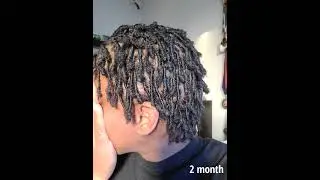 First 3 months of my loc journey!! (pictures)