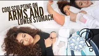 I had my fat frozen off! My Coolscuplting experience || Allthatbeautyjazz