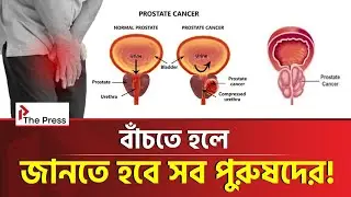 পুরুষদের কেন হয় প্রোস্টেট ক্যানসার? | Prostate Cancer | The Press
