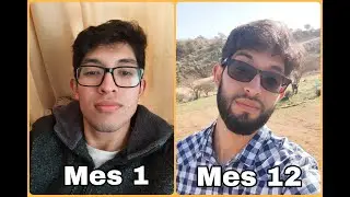 1 Año Usando Minoxidil | ¿Me Creció La Barba?  |  Progresos Mes a Mes