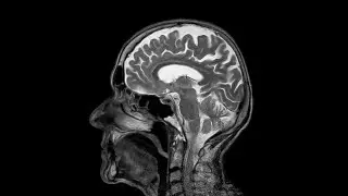 My Psychotic Experiences Thus Far (TRIGGER WARNING IN DESCRIPTION)
