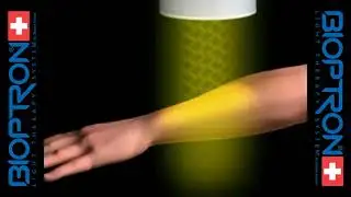 Что происходит в нашем организме во время сеанса светотерапии Биоптрон? ZEPTER BIOPTRON