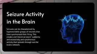 Understanding Epilepsy