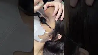 LASER SULAM ALIS