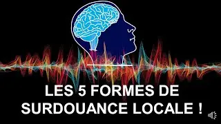SURDOUANCE LOCALE : LES 5 FORMES !