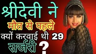 इस एक्ट्रेस ने करवाई थी 29 सर्जरी #Bollywood#facts
