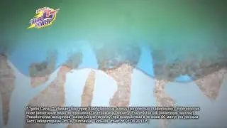 CillitBang WC 20'' 09 12 2014