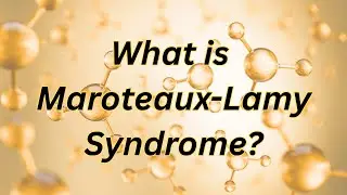 What is Maroteaux-Lamy Syndrome?