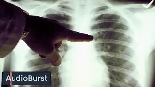 Dr. Paul Kalanithi's Widow On The Moment His Cancer Was Diagnosed