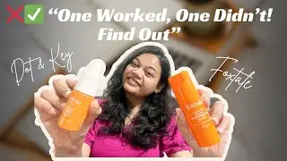&ldquo;Foxtale vs Dot & Key Vitamin C Serum 💧 Honest Review | Best for Glow & Pigmentation?&rdquo;