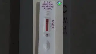 Malaria rapid diagnostic test | Malaria antigen test | Maleria test | plasmodium |MP
