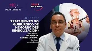 Tratamiento no quirúrgico de hemorroides (embolización)