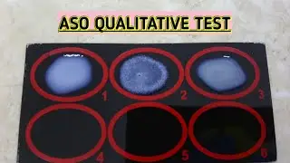 ASO (Anti streptolysin O Titre ) Test. Qualitative test (In English Demo).MLT WORLD