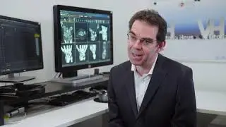 Cyclist Case Study Dr Rotstein I MED Radiology Victoria 04 19