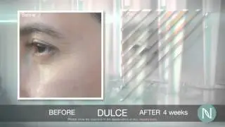 Nerium AD Before & After Photos
