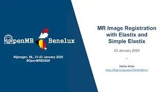 Stefan Klein: MR Image Registration with Elastix and Simple Elastix
