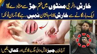Itching Gone in Minutes - Herbal Solution - Easy & Powerful Remedies for Psoriasis