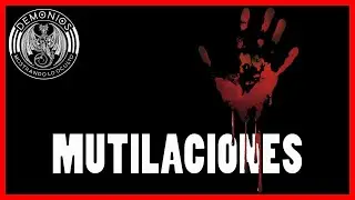 747 - MUTILACIONES
