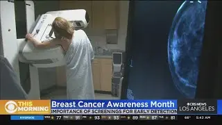 Susan G. Komen Foundation offering free mammograms to underserved communities during Breast Cancer A